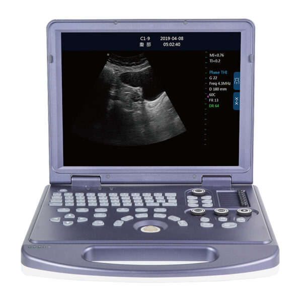 TG-360